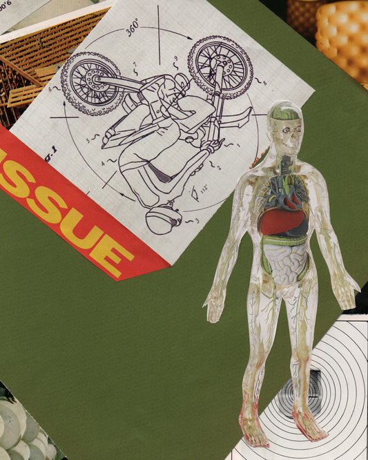 issue